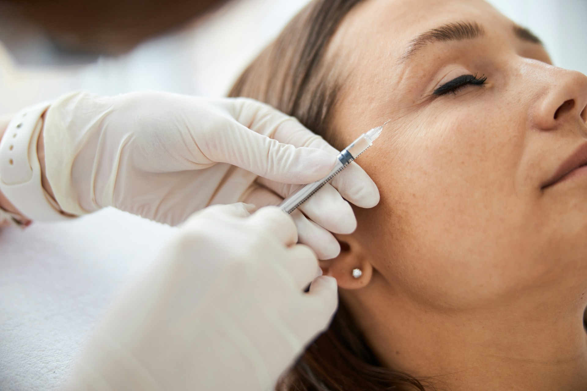 Injections du visage : construire un plan de traitement cohérent plutôt que corriger zone par zone